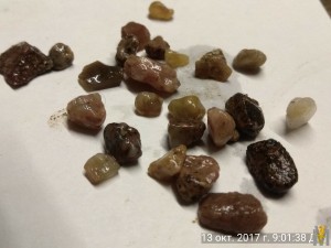 IMG_20171013_090138.jpg